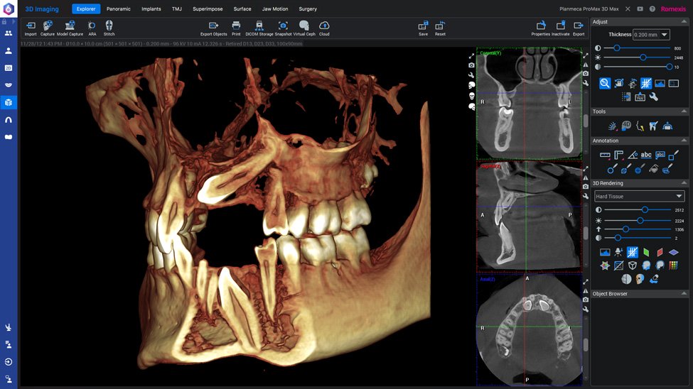 Программное обеспечение Planmeca для 3D визуализации