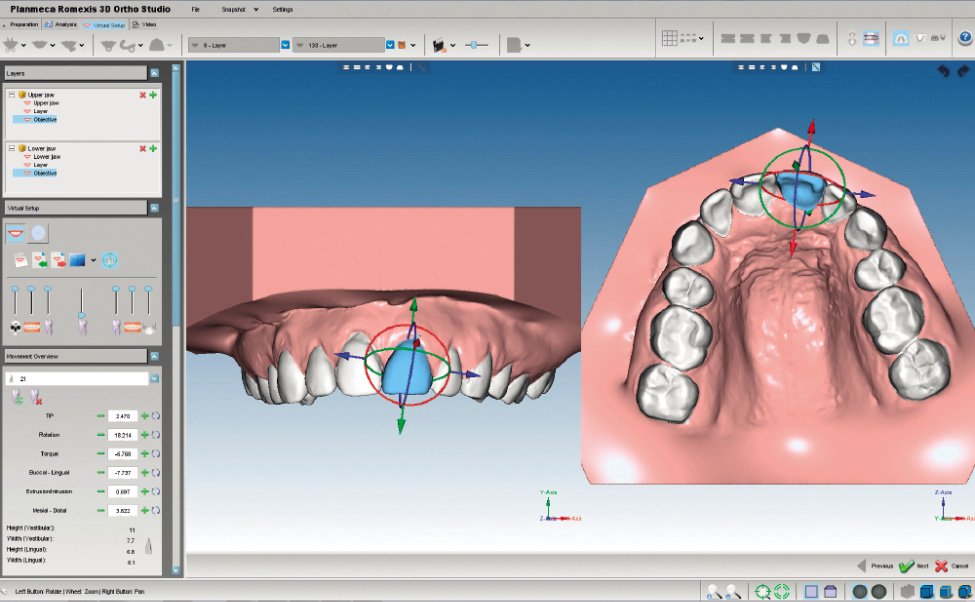Romexis® 3D Ortho Studio