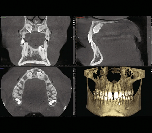 Рентген Planmeca ProMax 3D Max