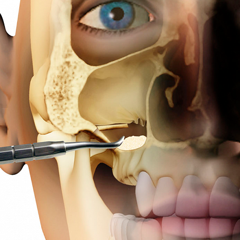 OsteoBiol®  Special