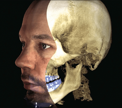 Рентген Planmeca ProMax 3D Classic