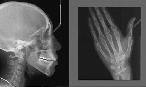 Рентген Planmeca ProMax 3D s