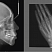 Рентген Planmeca ProMax 3D s