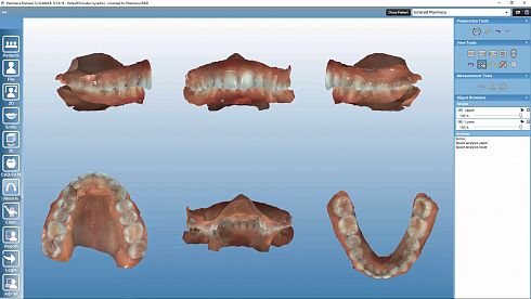 Romexis® Model Analyser